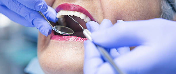 Best Emergency Root Canal Treatment in Rich Hill, MO